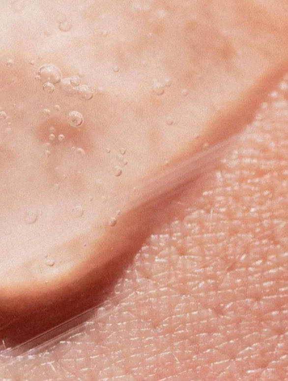 Concentré peeling AHA