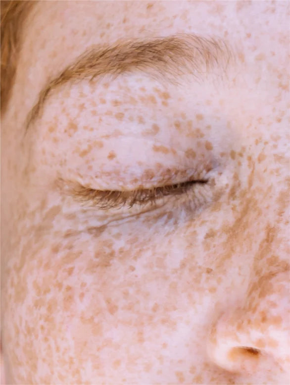 Sérum à la vitamine C