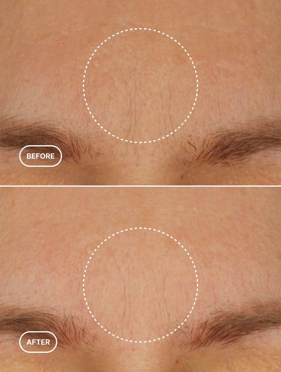 Retinol Alternative Moisturiser